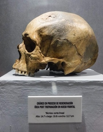 Museu Arqueológico de Ancash